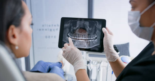 Licensed Tooth Extraction service in Columbia, MD - Smile Center Dentistry